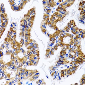 FASN / Fatty Acid Synthase Antibody