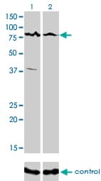 Monoclonal Mouse anti-Human CARF / ALS2CR8 Antibody (clone 2A3, IHC, IF, WB)