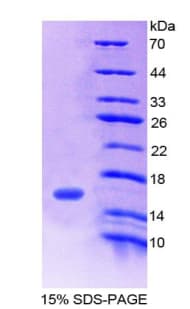 Human C1QTNF12 Protein (Recombinant His)