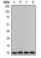 Polyclonal Rabbit anti-Human PTS Antibody (IF, WB)
