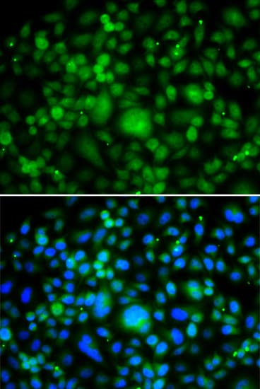 SMYD3 Antibody