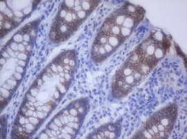 CDH1 / E Cadherin Antibody (clone OTI1F3)