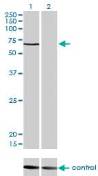 CACNB1 Antibody (clone 1G6)