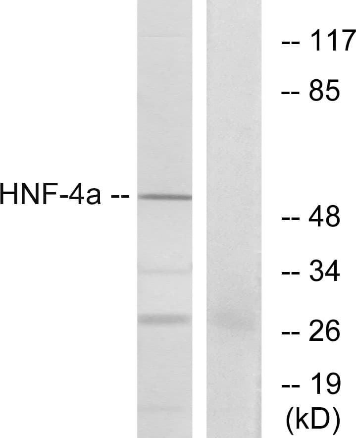 HNF4A / HNF4 Antibody (aa280-329)