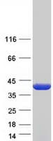 Human ALAD Protein (Recombinant Myc-DDK (Flag))