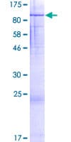 Human FIGNL1 Protein (Recombinant GST)