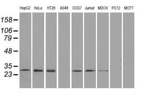 RPA2 / RFA2 / RPA34 Antibody (clone OTI7C12)