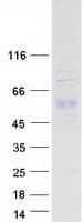 Human F7 / Factor VII Protein (Recombinant Myc-DDK (Flag))
