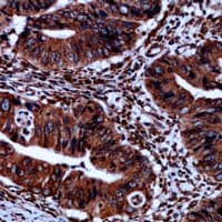 NOS2 / iNOS Antibody