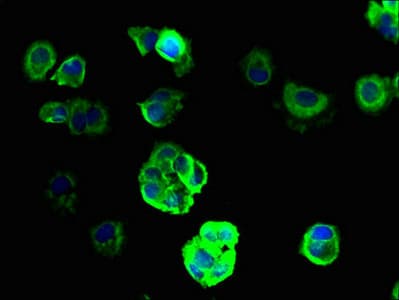 Polyclonal Rabbit anti-Human SCNN1G / ENaC Gamma Antibody (IHC)