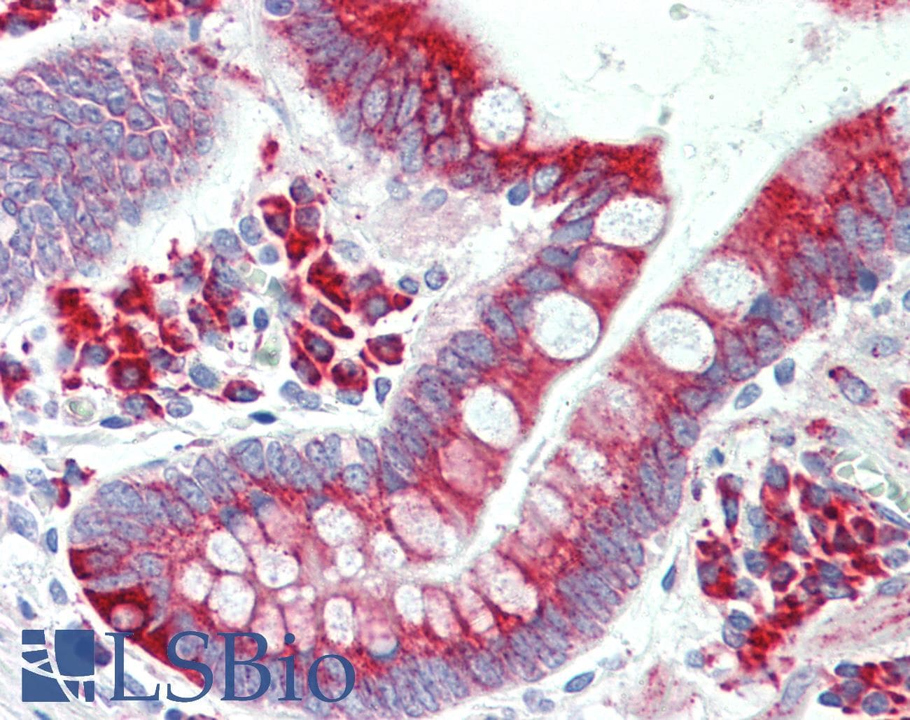 IHC-plus™ FADS1 Antibody (Internal, clone EPR6898)