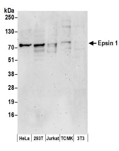 Epsin 1 / EPN1 Antibody (aa375-425)
