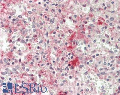 IHC-plus™ Monoclonal Mouse anti-Human CXCL4 / PF4 Antibody (clone RTO, IHC, WB)