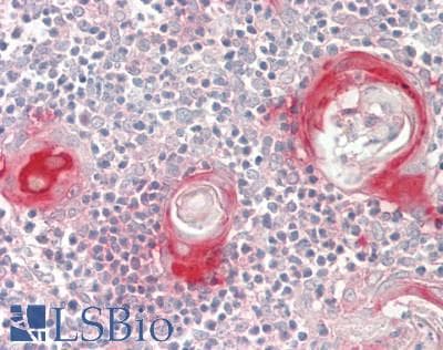 Delta-6 Desaturase / FADS2 Antibody