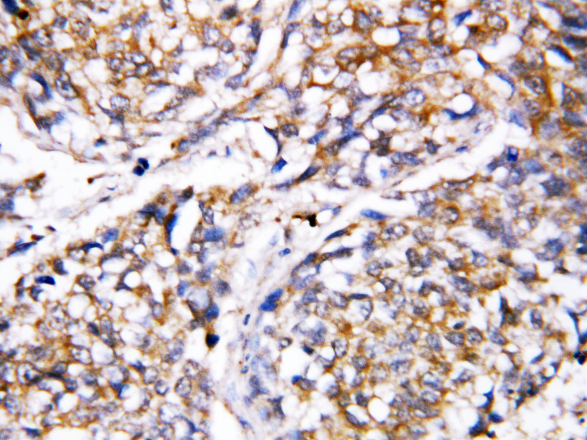 Polyclonal Rabbit anti-Human CASP4 / Caspase 4 Antibody (aa104-124, IHC, WB)