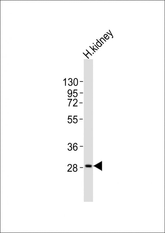 Polyclonal Rabbit anti-Human PAP2a / PPAP2A Antibody (aa247-281, WB)