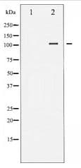 FAK / Focal Adhesion Kinase Antibody