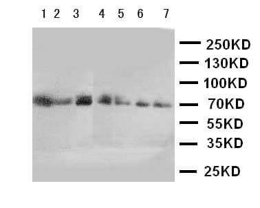 CYP11B1 Antibody (aa436-450)