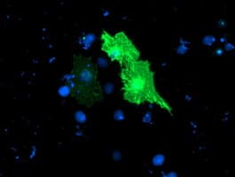 TULP3 Antibody (clone OTI4E5)