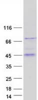 Human B3GALT5 Protein (Recombinant Myc-DDK (Flag))