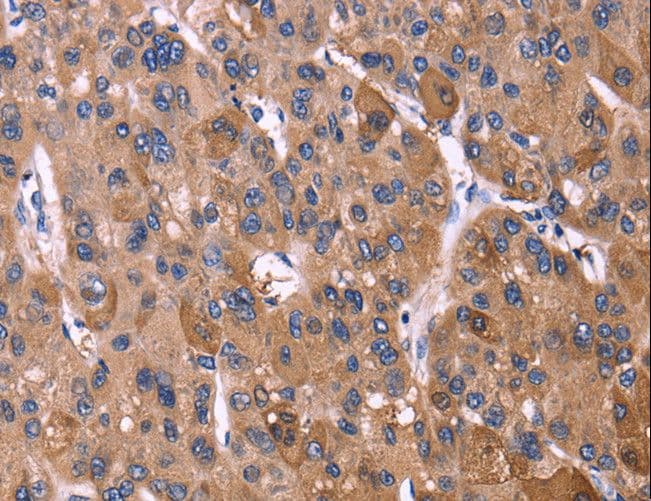 KIR2DL1+3+4 + KIR2DS4 Antibody