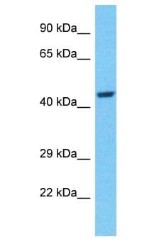 Polyclonal Rabbit anti-Human TADA2B Antibody (aa318-367, WB)