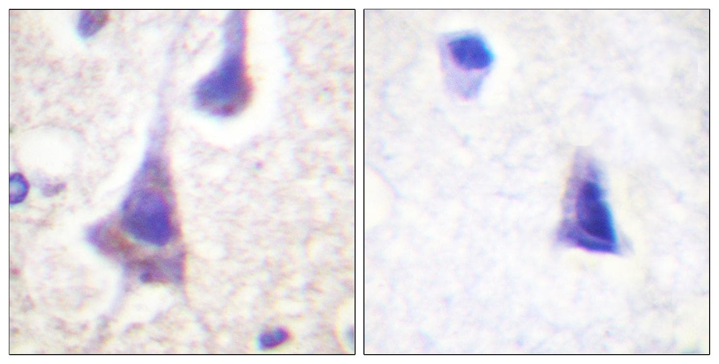 Polyclonal Rabbit anti-Human PTP1B Antibody (p50, IHC, WB)
