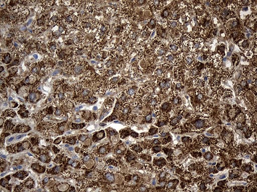 Monoclonal Mouse anti-Human ALDH7A1 Antibody (clone OTI10A12, IHC, WB)