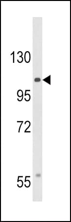 CACNA2D3 / Alpha-2/Delta-3 Antibody (aa1026-1053)