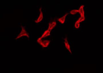 Polyclonal Rabbit anti-Human NCR1 / NKP46 Antibody (IF, WB)