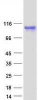 Human SOX6 Protein (Recombinant Myc-DDK (Flag))