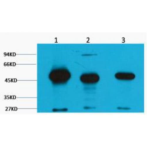 Monoclonal Mouse anti-Human FH / Fumarase / MCL Antibody (clone 2B11, IF, WB)