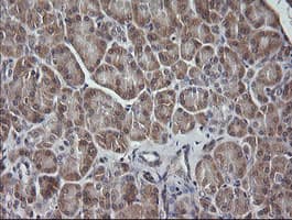 MAP2K3 / MEK3 / MKK3 Antibody (clone OTI5C7, Carrier-free)
