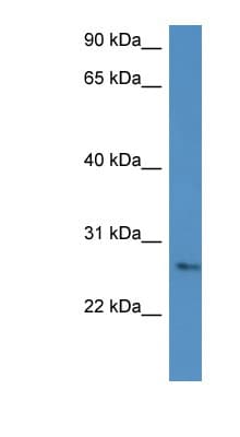 PathPlus™ CMA1 / Mast Cell Chymase Antibody (aa164-213)