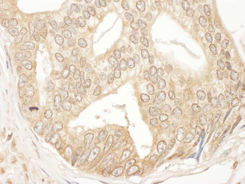 Polyclonal Rabbit anti-Human MAP2K2 / MKK2 / MEK2 Antibody (aa1-50, IHC, WB)