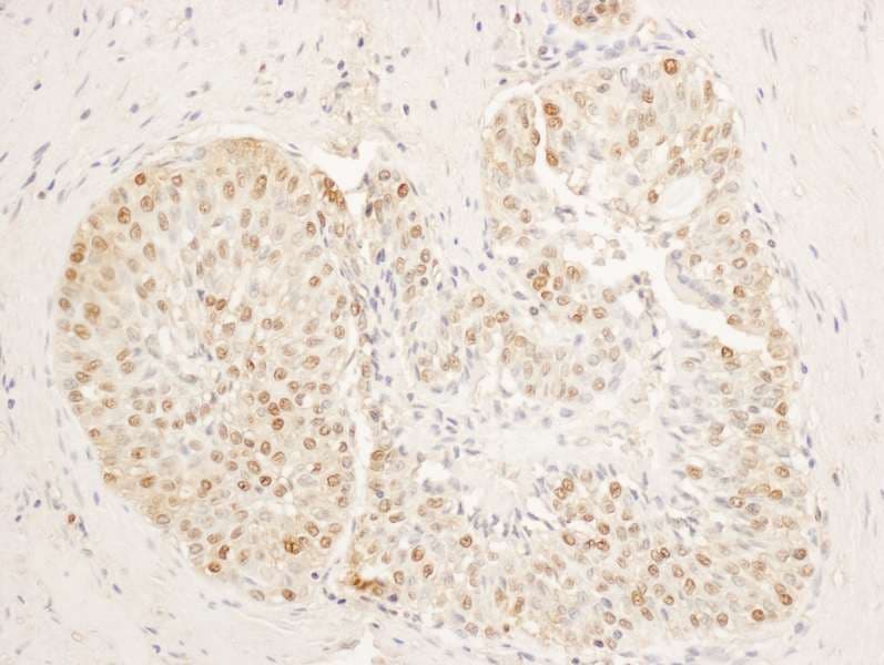 STAG1 / SA1 Antibody (aa25-75)
