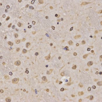 Polyclonal Rabbit anti-Human Histone H3 Antibody (Methyl-Lys36, IHC, IF, WB)