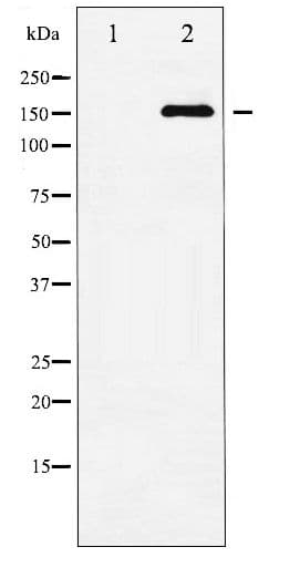 MAP3K5 / ASK1 Antibody (phospho-Ser83)