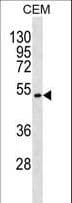 TOM1L2 Antibody (aa474-500)
