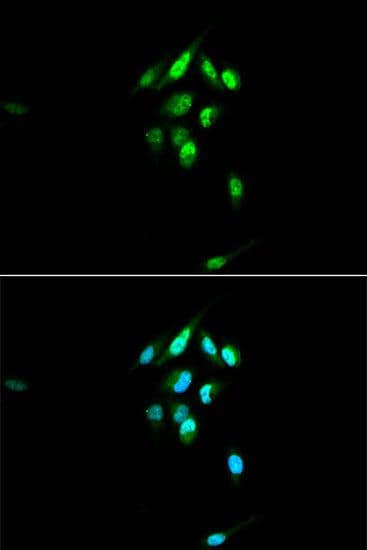 NR3C1/Glucocorticoid Receptor Antibody