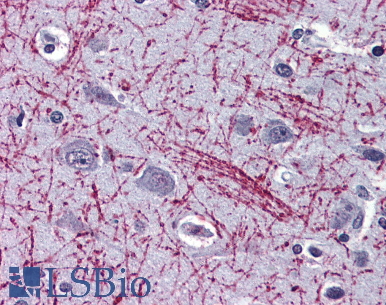 PathPlus™ Polyclonal Rabbit anti-Human OPRM1 / Mu Opioid Receptor Antibody (N-Terminus, IHC)