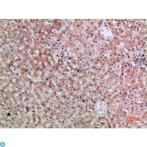 ERLIN1 / SPFH1 Antibody