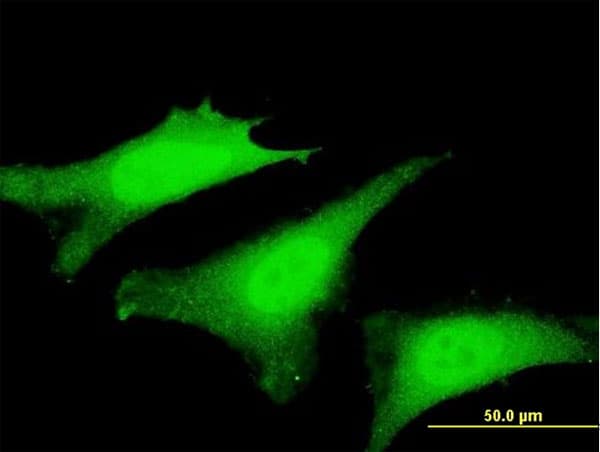 SVIL / Supervillin Antibody (clone 6E10)