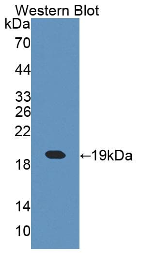 CRABP1 / CRABP Antibody (aa2-137)