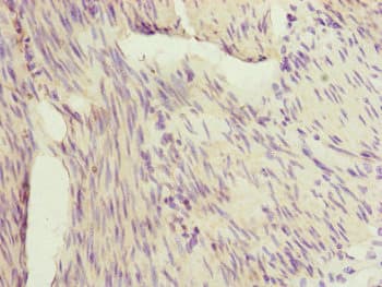 IL1F9 Antibody