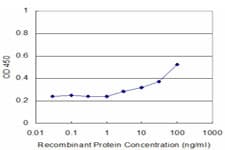 Monoclonal Mouse anti-Human GAN Antibody (clone 4G7, IF, WB)