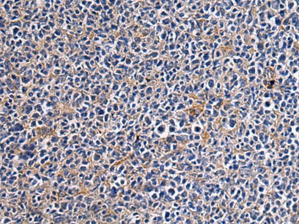 CEP89 Antibody