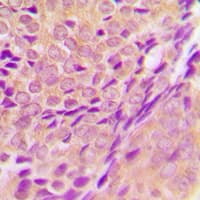 Polyclonal Rabbit anti-Human ZADH2 Antibody (Internal, IHC, WB)
