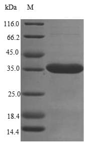 Mouse SUSD4 Protein (Recombinant 6His, N-terminus)