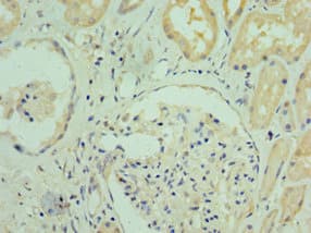RGS20 / RGSZ1 Antibody (aa1-241)